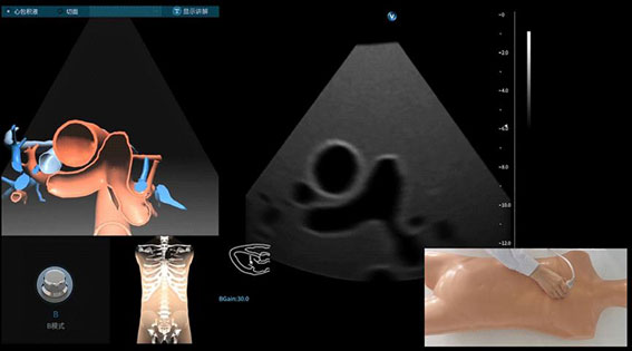 超聲模擬實訓(xùn)系統(tǒng) 單機(jī)版（女）